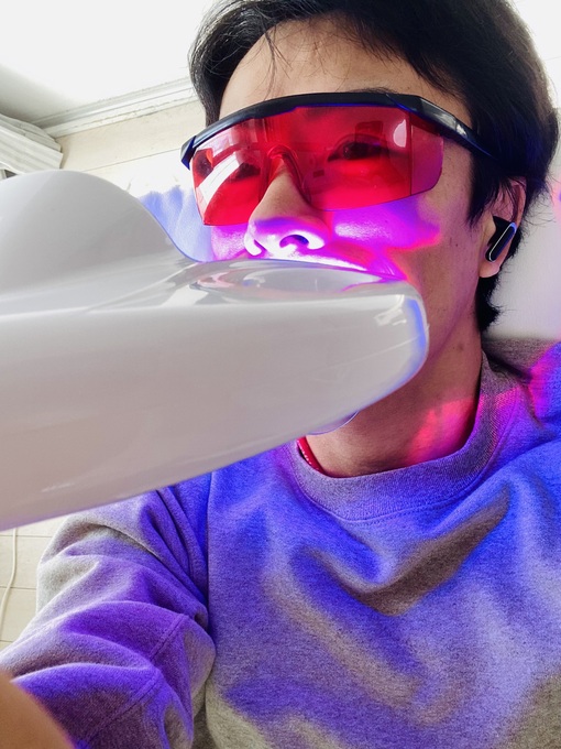 SHIN(ｼﾝ) 今日はホワイトニング