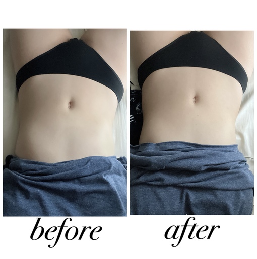 YURIA（ﾕﾘｱ） ビフォアフ