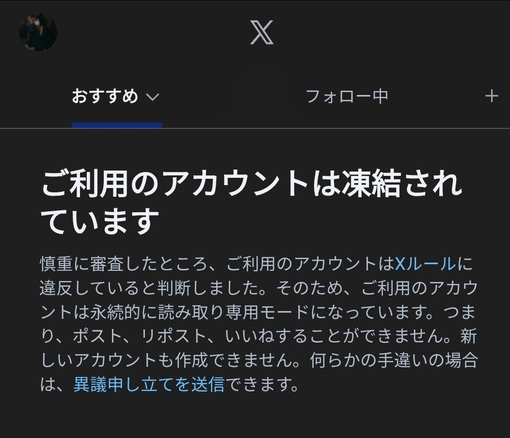 SHINYA(ｼﾝﾔ) Xについて