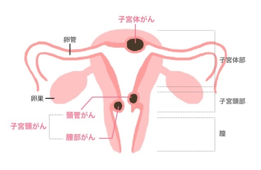 SHINYA(ｼﾝﾔ) 子宮体がんの日