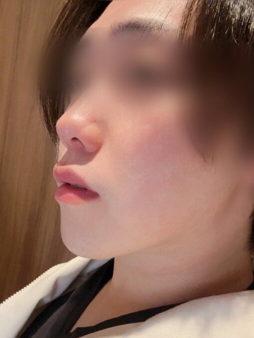 YUKICHI(ﾕｷﾁ)
